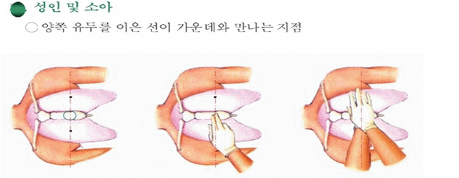 심폐소생술 익히기